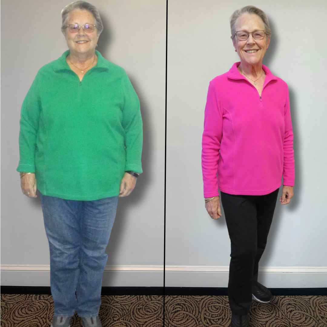 Sue before and after PHD Weight Loss, Down 95 lbs