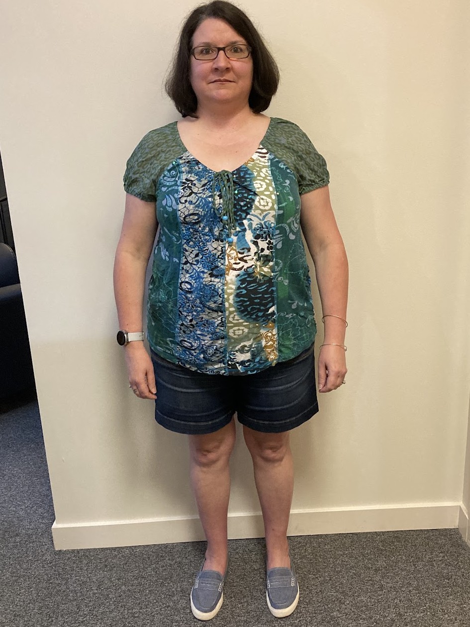 Dawn F before PHD Weight Loss