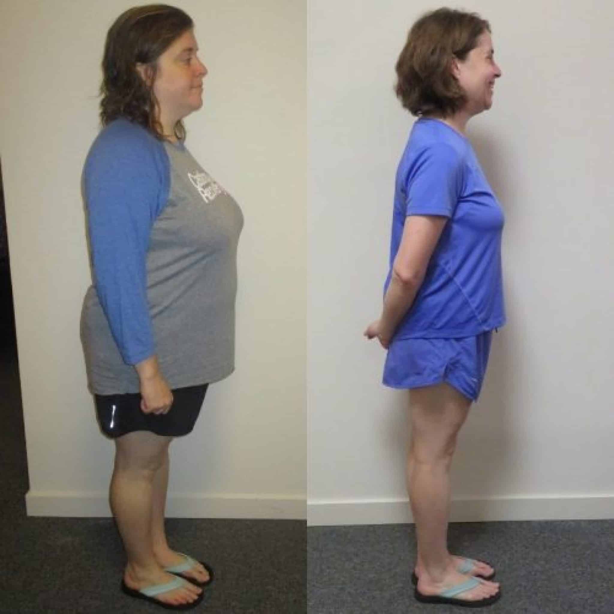 Greenville Weight Loss Center Lose Weight Fast