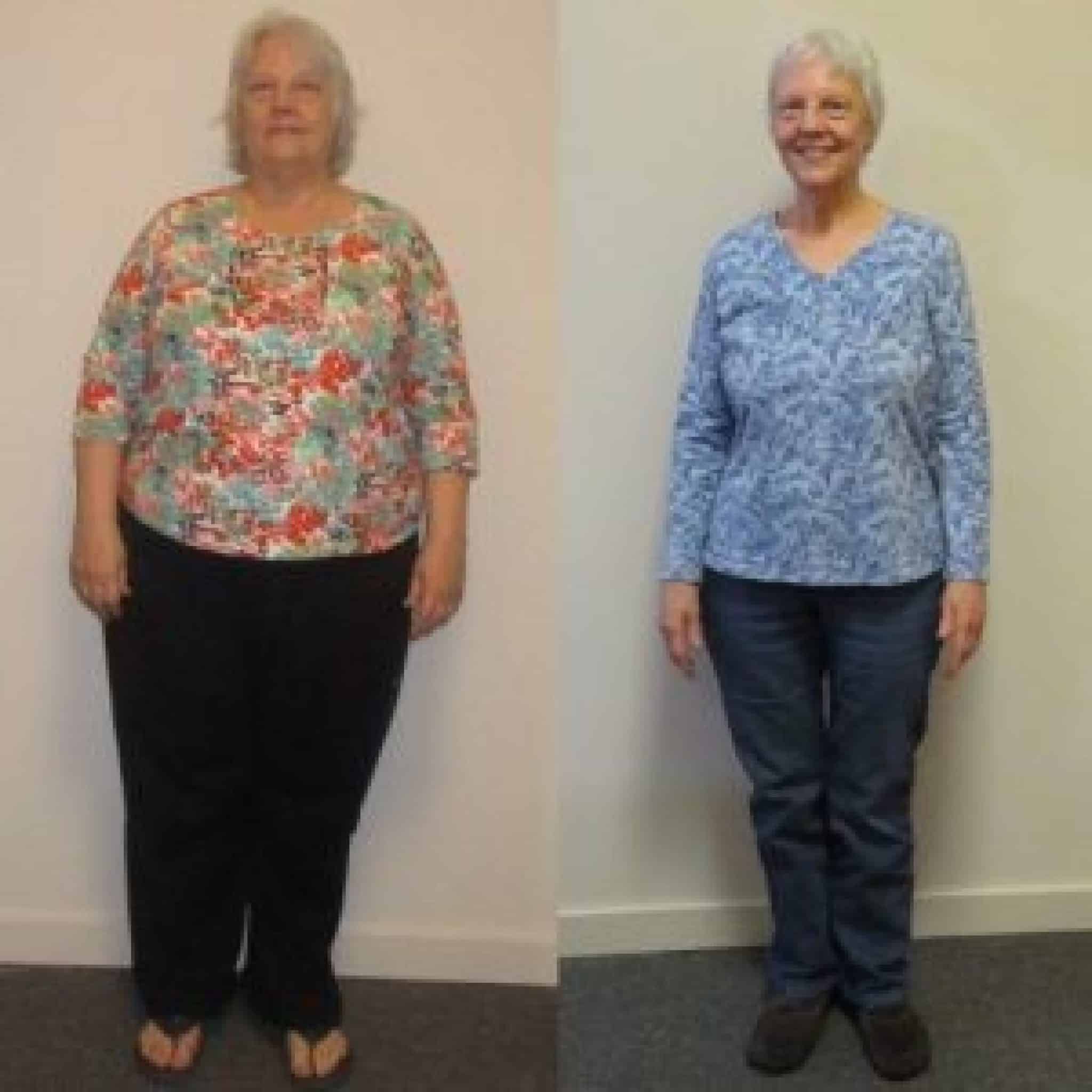 Greenville Weight Loss Center Lose Weight Fast