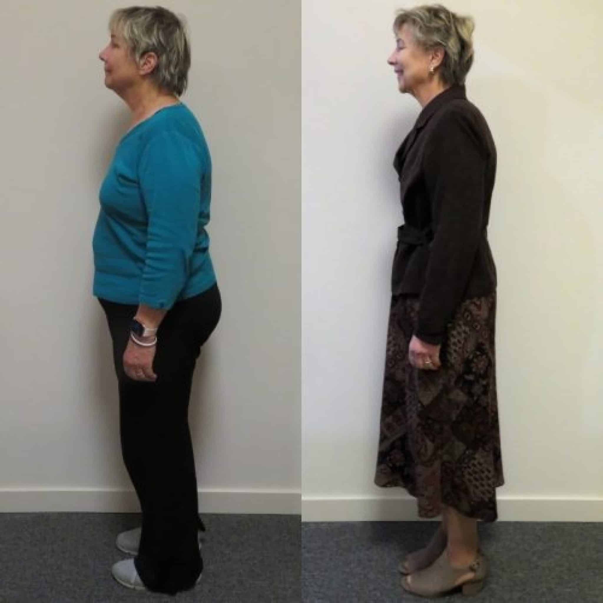 Greenville Weight Loss Center Lose Weight Fast